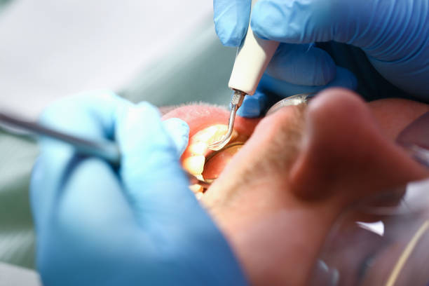 Best Holiday Emergency Dentist in Richmond Hill, GA