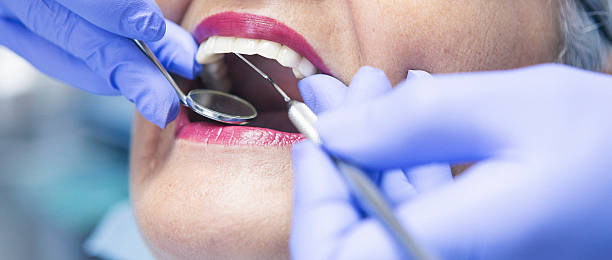 Best Emergency Dental Extractions in Richmond Hill, GA